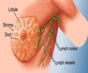 تقنية جديدة للكشف المبكر عن سرطان الثدي