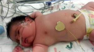 طفلة تزن أكثر من 6 كلغم