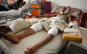 A man injured in a recent a car bomb attack lies on a hospital bed to receive treatment in Sanaa, Yemen. In a report released Tuesday, Aug. 18, Amnesty International says all sides fighting in Yemen have left a “trail of civilian death and destruction” in the conflict, killing scores of innocent people in what could amount to war crimes.